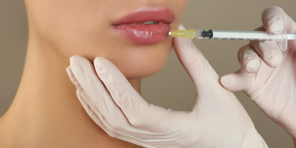 Lip Filler Injection Techniques and Methods in Aesthetic Medicine